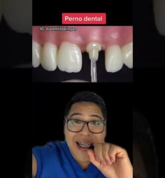 ¿Qué es un perno?