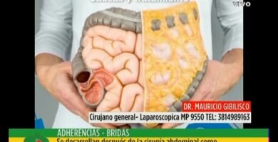 ¿Qué es una brida?